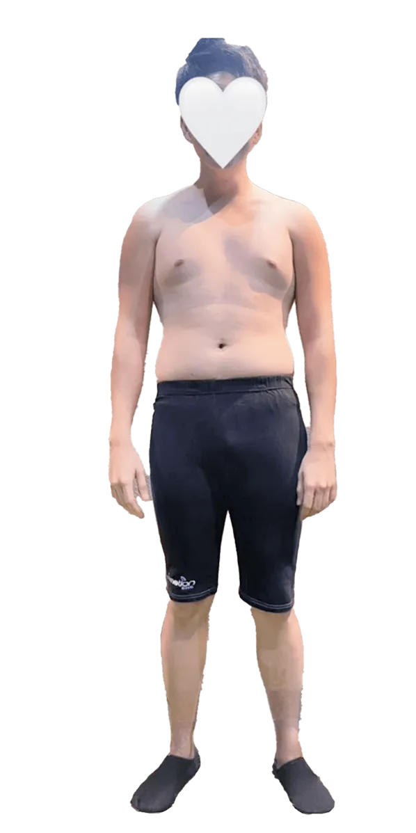 男性before